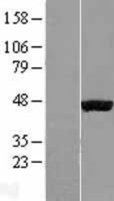 Western Blot: PHD1/HIF Prolyl Hydroxylase 1 Overexpression Lysate (Adult Normal) [NBL1-10155] Left-Empty vector transfected control cell lysate (HEK293 cell lysate); Right -Over-expression Lysate for HIF Prolyl Hydroxylase 1.