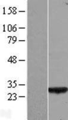 Western Blot: SELRC1 Overexpression Lysate (Adult Normal) [NBL1-08302] Left-Empty vector transfected control cell lysate (HEK293 cell lysate); Right -Over-expression Lysate for SELRC1.