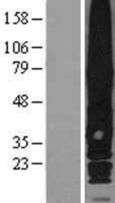 Western Blot: RAI3 Overexpression Lysate (Adult Normal) [NBL1-11303] Left-Empty vector transfected control cell lysate (HEK293 cell lysate); Right -Over-expression Lysate for RAI3.