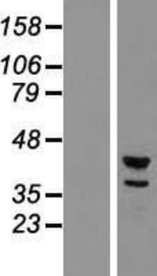 Western Blot: CDC2L2 Overexpression Lysate (Adult Normal) [NBL1-08999] Left-Empty vector transfected control cell lysate (HEK293 cell lysate); Right -Over-expression Lysate for CDC2L2.