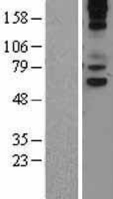 Western Blot: VNN1 Overexpression Lysate (Adult Normal) [NBL1-17732] Left-Empty vector transfected control cell lysate (HEK293 cell lysate); Right -Over-expression Lysate for VNN1.
