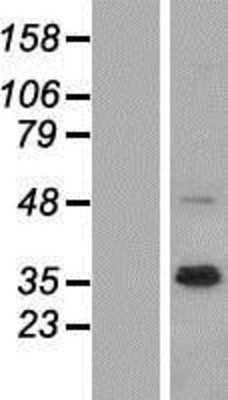 Western Blot: NRG1 Overexpression Lysate (Adult Normal) [NBP2-09853] Left-Empty vector transfected control cell lysate (HEK293 cell lysate); Right -Over-expression Lysate for NRG1.