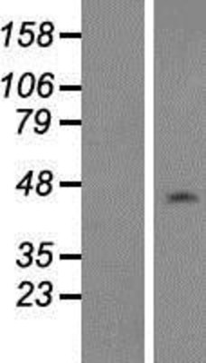Western Blot: NAP1L1 Overexpression Lysate (Adult Normal) [NBP2-09975] Left-Empty vector transfected control cell lysate (HEK293 cell lysate); Right -Over-expression Lysate for NAP1L1.