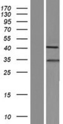 Western Blot: SHOX2 Overexpression Lysate (Adult Normal) [NBP2-10141] Left-Empty vector transfected control cell lysate (HEK293 cell lysate); Right -Over-expression Lysate for SHOX2.