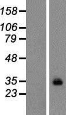 Western Blot: GPM6A Overexpression Lysate (Adult Normal) [NBP2-10116] Left-Empty vector transfected control cell lysate (HEK293 cell lysate); Right -Over-expression Lysate for GPM6A.
