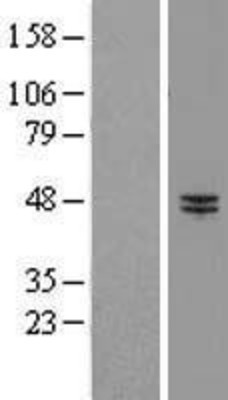 Western Blot: RNF13 Overexpression Lysate (Adult Normal) [NBP2-10067] Left-Empty vector transfected control cell lysate (HEK293 cell lysate); Right -Over-expression Lysate for RNF13.