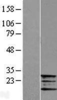 Western Blot: Frataxin Overexpression Lysate (Adult Normal) [NBL1-10871] Left-Empty vector transfected control cell lysate (HEK293 cell lysate); Right -Over-expression Lysate for Frataxin.