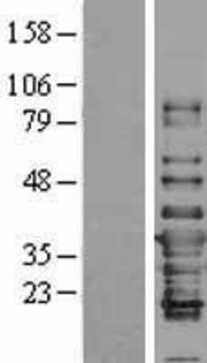 Western Blot: IFI35 Overexpression Lysate (Adult Normal) [NBL1-11829] Left-Empty vector transfected control cell lysate (HEK293 cell lysate); Right -Over-expression Lysate for IFI35.
