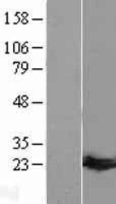 Western Blot: Guanylate kinase Overexpression Lysate (Adult Normal) [NBL1-11411] Left-Empty vector transfected control cell lysate (HEK293 cell lysate); Right -Over-expression Lysate for Guanylate kinase.