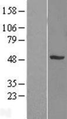 Western Blot: SNX5 Overexpression Lysate (Adult Normal) [NBL1-16318] Left-Empty vector transfected control cell lysate (HEK293 cell lysate); Right -Over-expression Lysate for SNX5.