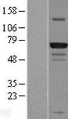 Western Blot: GPATCH3 Overexpression Lysate (Adult Normal) [NBL1-11215] Left-Empty vector transfected control cell lysate (HEK293 cell lysate); Right -Over-expression Lysate for GPATCH3.