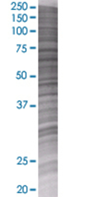 ORC3L transfected lysate.