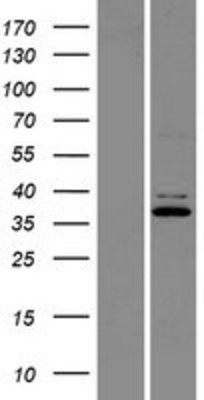 Western Blot: C9orf4 Overexpression Lysate (Adult Normal) [NBP2-07352] Left-Empty vector transfected control cell lysate (HEK293 cell lysate); Right -Over-expression Lysate for C9orf4.