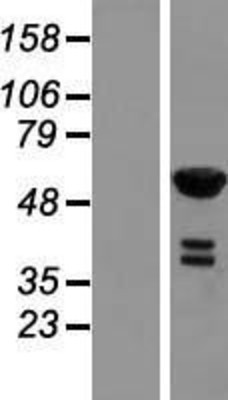 Western Blot: RFTN2 Overexpression Lysate (Adult Normal) [NBL1-15302] Left-Empty vector transfected control cell lysate (HEK293 cell lysate); Right -Over-expression Lysate for RFTN2.