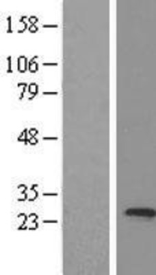 Western Blot: MED20 Overexpression Lysate (Adult Normal) [NBL1-12985] Left-Empty vector transfected control cell lysate (HEK293 cell lysate); Right -Over-expression Lysate for MED20.
