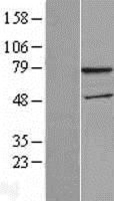 Western Blot: WDTC1 Overexpression Lysate (Adult Normal) [NBL1-17839] Left-Empty vector transfected control cell lysate (HEK293 cell lysate); Right -Over-expression Lysate for WDTC1.