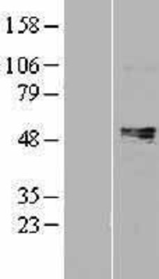 Western Blot: Prostaglandin E Receptor EP4 Overexpression Lysate (Adult Normal) [NBL1-14934] Left-Empty vector transfected control cell lysate (HEK293 cell lysate); Right -Over-expression Lysate for Prostaglandin E Receptor EP4.