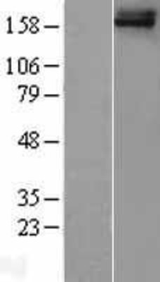 Western Blot: FREM1 Overexpression Lysate (Adult Normal) [NBL1-10830] Left-Empty vector transfected control cell lysate (HEK293 cell lysate); Right -Over-expression Lysate for FREM1.