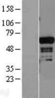 Western Blot: ADAM28 Overexpression Lysate (Adult Normal) [NBL1-07309] Left-Empty vector transfected control cell lysate (HEK293 cell lysate); Right -Over-expression Lysate for ADAM28.