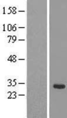 Western Blot: SRrp35 Overexpression Lysate (Adult Normal) [NBL1-16461] Left-Empty vector transfected control cell lysate (HEK293 cell lysate); Right -Over-expression Lysate for SRrp35.