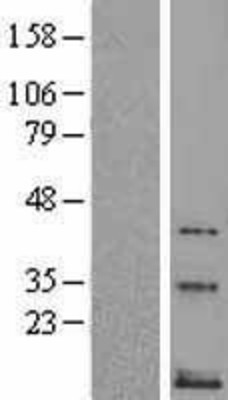 Western Blot: Neurokinin B Overexpression Lysate (Adult Normal) [NBL1-16669] Left-Empty vector transfected control cell lysate (HEK293 cell lysate); Right -Over-expression Lysate for Neurokinin B.