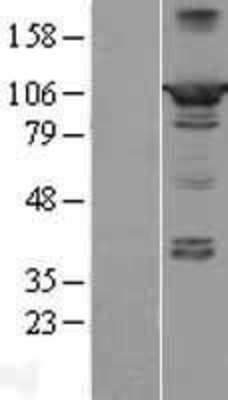 Western Blot: PPFIBP2 Overexpression Lysate (Adult Normal) [NBL1-14643] Left-Empty vector transfected control cell lysate (HEK293 cell lysate); Right -Over-expression Lysate for PPFIBP2.