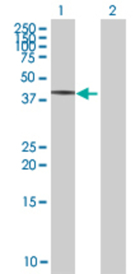 Lane 1: CHX10 transfected lysate (39.82 KDa) Lane 2: Non-transfected lysate.