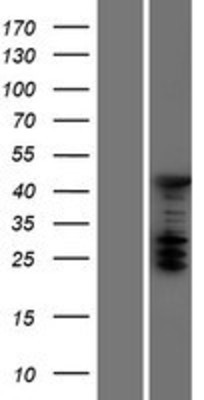 Western Blot: ASC1 Overexpression Lysate (Adult Normal) [NBP2-07073] Left-Empty vector transfected control cell lysate (HEK293 cell lysate); Right -Over-expression Lysate for ASC1.