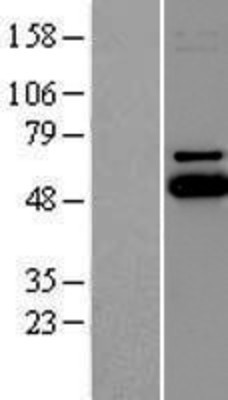 Western Blot: UBE2Q1 Overexpression Lysate (Adult Normal) [NBP2-06958] Left-Empty vector transfected control cell lysate (HEK293 cell lysate); Right -Over-expression Lysate for UBE2Q1.