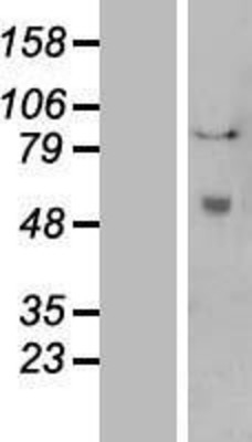 Western Blot: Tissue Plasminogen Activator Overexpression Lysate (Adult Normal) [NBL1-14485] Left-Empty vector transfected control cell lysate (HEK293 cell lysate); Right -Over-expression Lysate for Tissue Plasminogen Activator.
