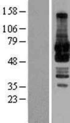 Western Blot: GRASP65 Overexpression Lysate (Adult Normal) [NBL1-11202] Left-Empty vector transfected control cell lysate (HEK293 cell lysate); Right -Over-expression Lysate for GRASP65.