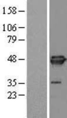 Western Blot: EIF4A3 Overexpression Lysate (Adult Normal) [NBL1-10203] Left-Empty vector transfected control cell lysate (HEK293 cell lysate); Right -Over-expression Lysate for EIF4A3.