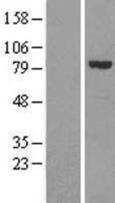 Western Blot: Calpain 6 Overexpression Lysate (Adult Normal) [NBL1-08682] Left-Empty vector transfected control cell lysate (HEK293 cell lysate); Right -Over-expression Lysate for Calpain 6.