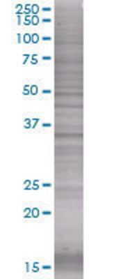 EEF1D transfected lysate