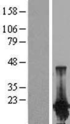 Western Blot: PPP1R14D/GBPI-1 Overexpression Lysate (Adult Normal) [NBP2-06935] Left-Empty vector transfected control cell lysate (HEK293 cell lysate); Right -Over-expression Lysate for PPP1R14D/GBPI-1.