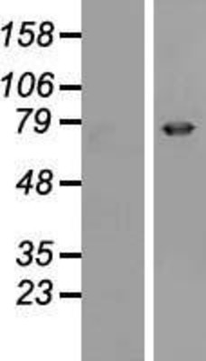 Western Blot: Epsin 3 Overexpression Lysate (Adult Normal) [NBP2-06890] Left-Empty vector transfected control cell lysate (HEK293 cell lysate); Right -Over-expression Lysate for Epsin 3.