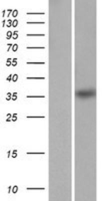 Western Blot: HMX1 Overexpression Lysate (Adult Normal) [NBP2-06757] Left-Empty vector transfected control cell lysate (HEK293 cell lysate); Right -Over-expression Lysate for HMX1.