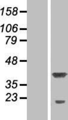 Western Blot: P15RS Overexpression Lysate (Adult Normal) [NBP2-06863] Left-Empty vector transfected control cell lysate (HEK293 cell lysate); Right -Over-expression Lysate for P15RS.