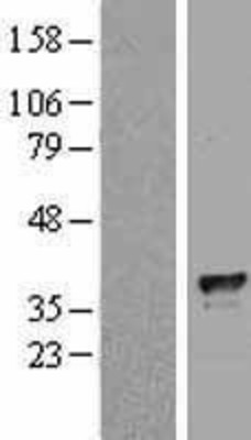 Western Blot: TFIIB Overexpression Lysate (Adult Normal) [NBL1-11384] Left-Empty vector transfected control cell lysate (HEK293 cell lysate); Right -Over-expression Lysate for TFIIB.