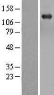 Western Blot: TBC1D1 Overexpression Lysate (Adult Normal) [NBL1-16719] Left-Empty vector transfected control cell lysate (HEK293 cell lysate); Right -Over-expression Lysate for TBC1D1.