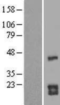 Western Blot: CDC42 Overexpression Lysate (Adult Normal) [NBL1-09005] Left-Empty vector transfected control cell lysate (HEK293 cell lysate); Right -Over-expression Lysate for CDC42.