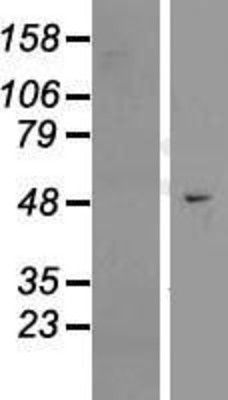Western Blot: EFCAB3 Overexpression Lysate (Adult Normal) [NBL1-10131] Left-Empty vector transfected control cell lysate (HEK293 cell lysate); Right -Over-expression Lysate for EFCAB3.