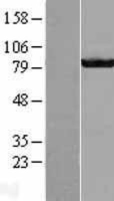 Western Blot: GBE1 Overexpression Lysate (Adult Normal) [NBL1-10994] Left-Empty vector transfected control cell lysate (HEK293 cell lysate); Right -Over-expression Lysate for GBE1.
