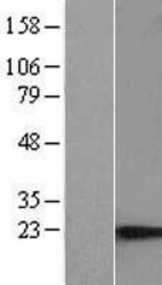Western Blot: C9orf9 Overexpression Lysate (Adult Normal) [NBP2-06754] Left-Empty vector transfected control cell lysate (HEK293 cell lysate); Right -Over-expression Lysate for C9orf9.