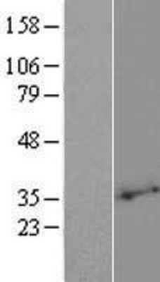 Western Blot: PLSCR2 Overexpression Lysate (Adult Normal) [NBP2-06661] Left-Empty vector transfected control cell lysate (HEK293 cell lysate); Right -Over-expression Lysate for PLSCR2.