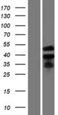 Western Blot: ETV2 Overexpression Lysate (Adult Normal) [NBP2-07373] Left-Empty vector transfected control cell lysate (HEK293 cell lysate); Right -Over-expression Lysate for ETV2.
