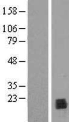 Western Blot: PPIL1 Overexpression Lysate (Adult Normal) [NBL1-14651] Left-Empty vector transfected control cell lysate (HEK293 cell lysate); Right -Over-expression Lysate for PPIL1.