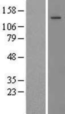 Western Blot: Thrombospondin 2 Overexpression Lysate (Adult Normal) [NBL1-16879] Left-Empty vector transfected control cell lysate (HEK293 cell lysate); Right -Over-expression Lysate for Thrombospondin 2.