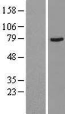 Western Blot: Muscarinic Acetylcholine Receptor M3 Overexpression Lysate (Adult Normal) [NBL1-09175] Left-Empty vector transfected control cell lysate (HEK293 cell lysate); Right -Over-expression Lysate for Muscarinic Acetylcholine Receptor M3.