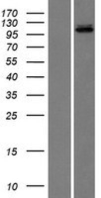 Western Blot: DNA Ligase III Overexpression Lysate (Adult Normal) [NBL1-12520] Left-Empty vector transfected control cell lysate (HEK293 cell lysate); Right -Over-expression Lysate for DNA Ligase III.